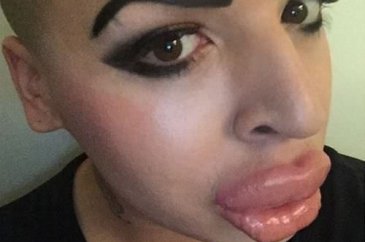Kim Kardashian'a benzemek istedi!