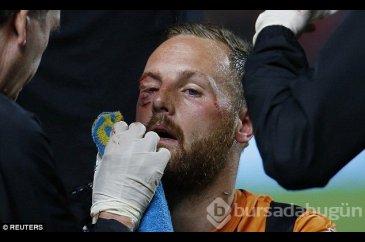 David Meyler gözünü kaybediyordu!