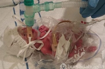Sandviç poşeti hayatını kurtardı