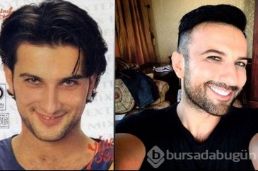 Gülümsemesini estetiğe borçlu ünlüler!
