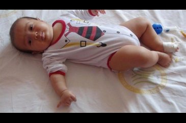 24 parmaklı bebek!
