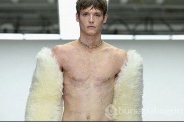 Vücudunun yüzde 90'ı yanan model tekrar podyumlarda