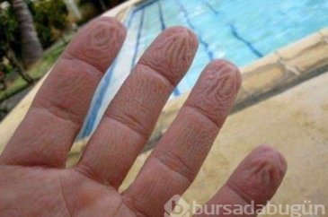 Parmaklar suda neden buruşur? İşte mucizenin cevabı