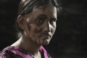 Asit kurbanları