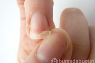Tırnak kırılmasını engellemek için ne yapmalı