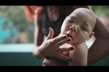Zika virüsü nedir? Nasıl yayılır?