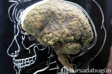 Ölülere 'diriltme' deneyi yapılacak