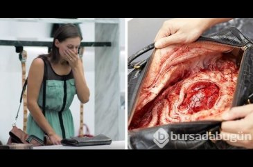 Çantayı açınca dehşete düştü