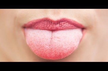 Diline bak hastalığını öğren