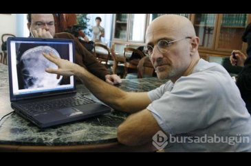 "İlk kafa nakli operasyonu 2017'de gerçekleşecek"