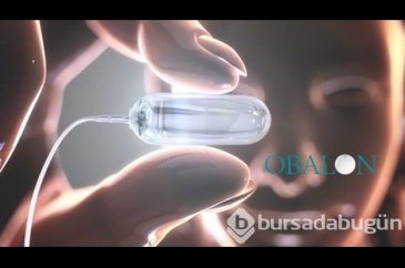 Zayıflamak için 'balon' yutma önerisi