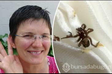 Korkunç ağrının arkasından örümcek çıkınca dehşete düştü