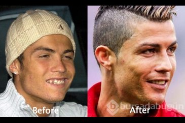 Cristiano Ronaldo'nun estetik ameliyatları