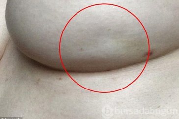 O belirtiyi fark etti, hayatı kurtuldu