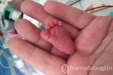Mucize bebekler