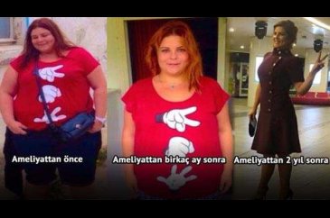 Pelin Öztekin 70 kiloya düştü