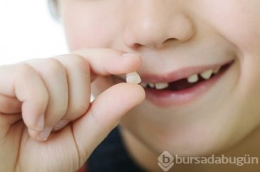 Çocuğunuzun süt dişlerini atmayın!