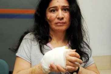 Hastalığı dünyada sadece 250 kişide var