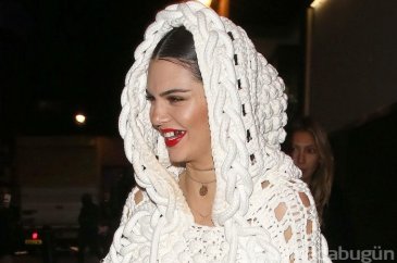 Kendall Jenner'ın altın dişleri olay oldu!
