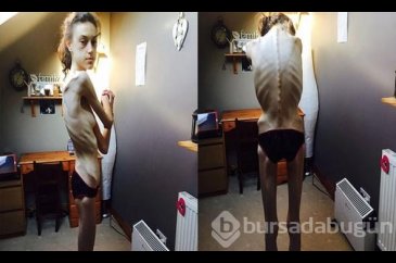 'Erkek arkadaş bulamıyorum' diye hasta olmuştu son hali şoke etti!
