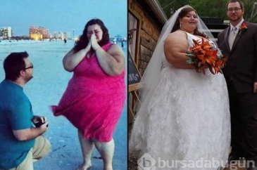 Ameliyat olmadan 200 kilo verdiler
