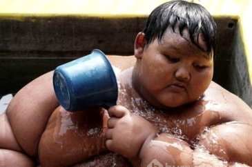 Günde 5 öğün pilav yedi 192 kilo oldu!