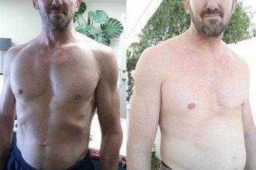 Günde 10 kola içen adamın son hali