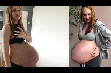 Kimse cesaret edemezdi! Doğumdan sonra o kareyi paylaştı
