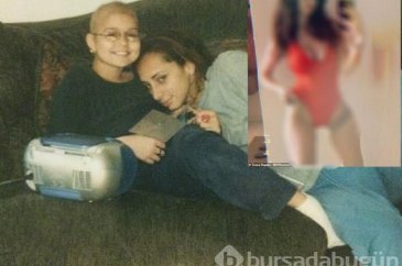 11 yaşında kanser oldu, bacağını aldılar! Şimdi markaların peşinden...