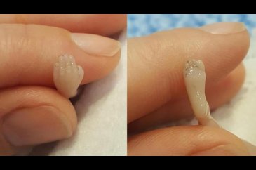 Ölü doğan bebeğinin fotoğraflarını paylaştı