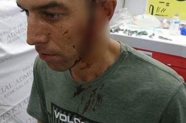 Koca bıçak başına saplandı! 