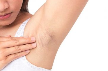 İnsanlar tarafından önemsenmeyen erken kanser belirtileri
