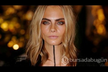 Cara Delevingne çekimde sakatlandı
