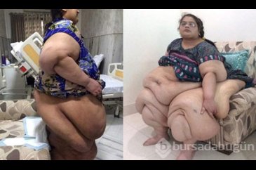 2 senede 175 kilo verdi! Şimdi bambaşka biri
