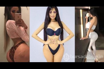 Kim Kardashian gibi görünmek için kalçasına 2,5 kilo yağ enjekte et...