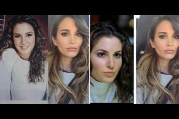 Ünlülerin estetik karnesi
