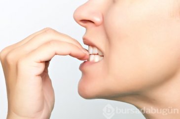 Tırnak yeme nedir? 