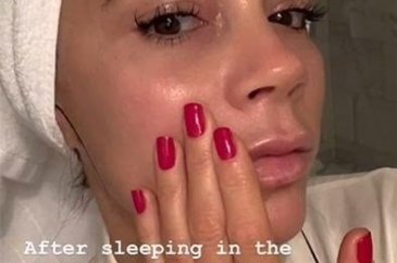 Victoria Beckham kendi kanından krem yaptırdı