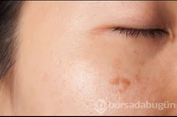 Doğru kapatıcıyı seçmenin püf noktaları
