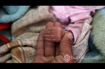 Yemen'de kıtlık en çok çocukları etkiliyor
