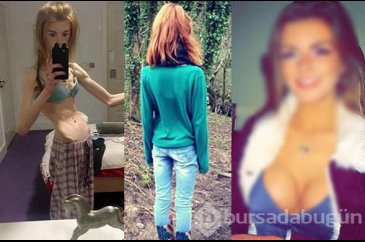 Anoreksiya hastalığına yakalanmıştı, şimdi ise bambaşka biri!
