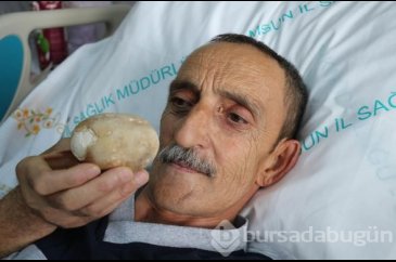 Doktorlar şoke oldu: Görünce patates sandım

