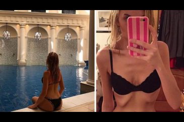 38 kiloya düşmüştü o şimdi bambaşka birine dönüştü!
