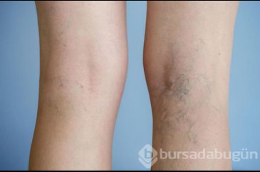  Sinsice ilerliyor, bahar aylarında ortaya çıkıyor 