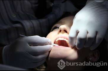  Dişlerin arasına sıkışan et artıklarına dikkat! Tehlike yaratıyor 