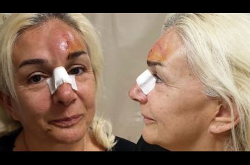Burçin Orhon sevenlerini korkuttu
