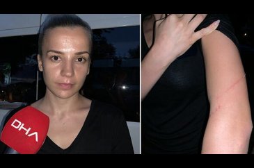 Servis şoförü dehşet yaşattı