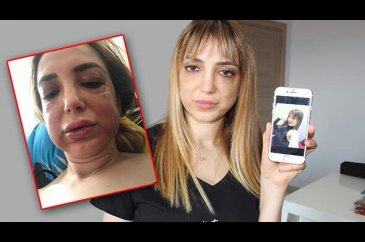 Estetik mağduru kadının yüzü tanınmaz hale geldi