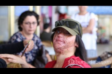 Berfin'in yüzüne asit atan eski erkek arkadaşı:''Suçsuzum''