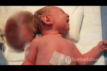 Elif bebek ameliyat edildi